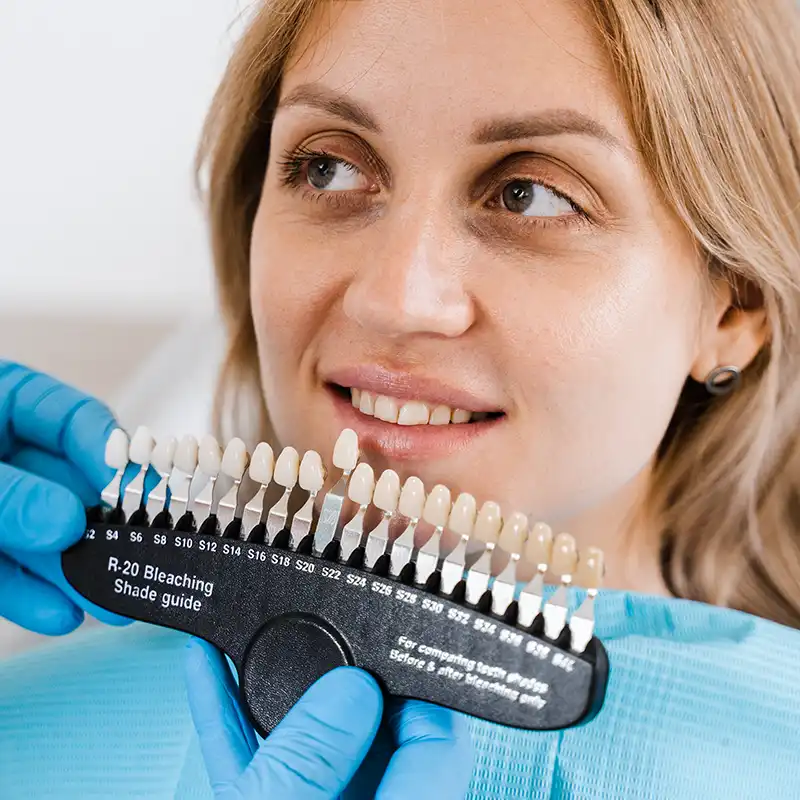 Faccette dentali a Mantova