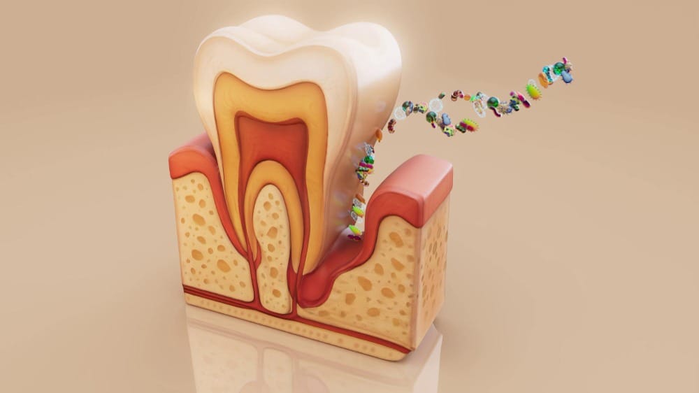 cosa fare per non perdere il dente cariato